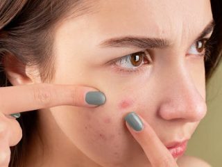 Managing Stress for Healthier Skin - Essential Skincare Tips